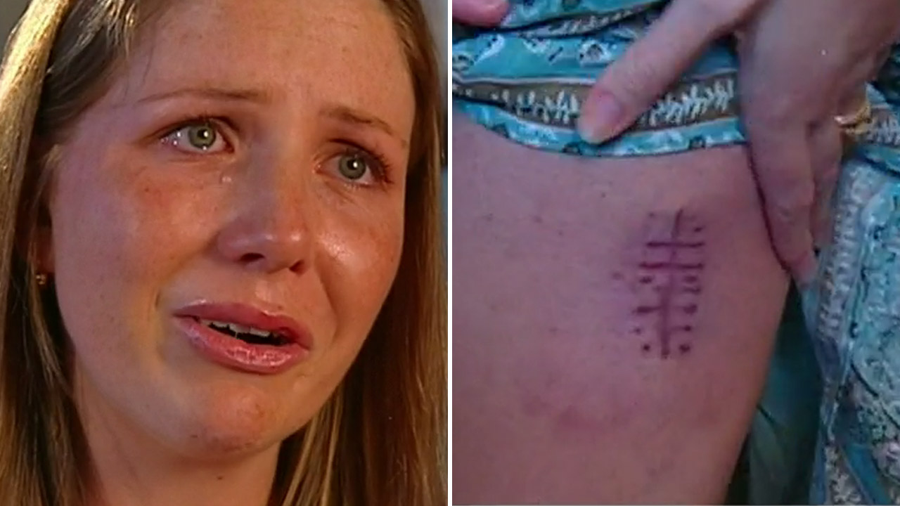 Young mum diagnosed with melanoma has a message for all Australians